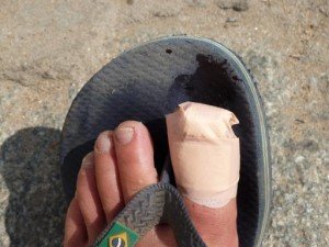 toe injury