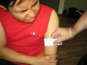 Dealing with stings by removing the stinger with a card